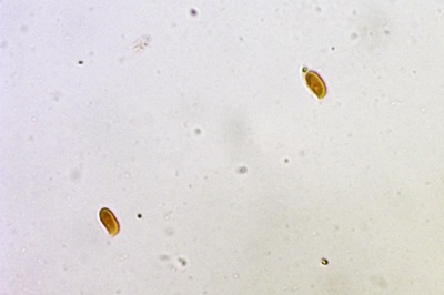 pleurotus-pulmonarius7