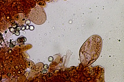 pluteus-romellii10