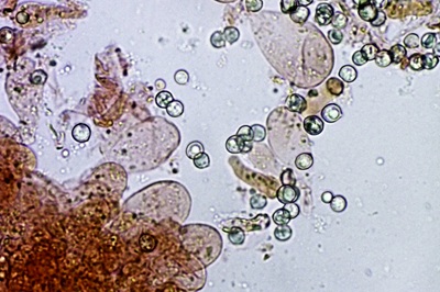 pluteus-romellii11