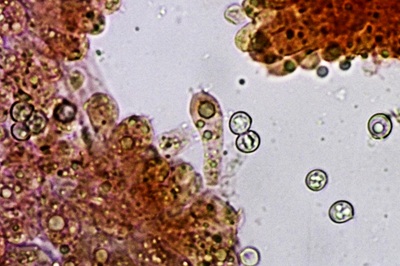 pluteus-romellii8