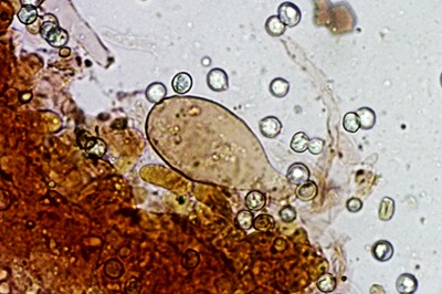 pluteus-romellii9
