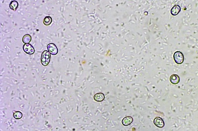 pluteus-salicinus5
