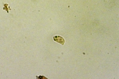 pseudoclitocybe-cyathiformis10