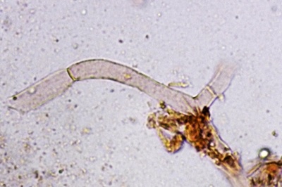 pseudoclitocybe-cyathiformis12