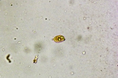 pseudoclitocybe-cyathiformis9