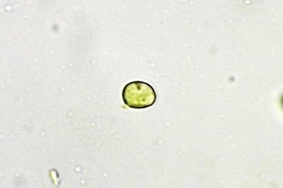 pseudoporpoloma-pes-caprae