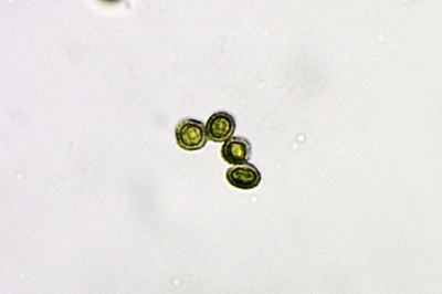 reticularia-lycoperdon11