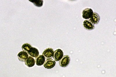 reticularia-lycoperdon12