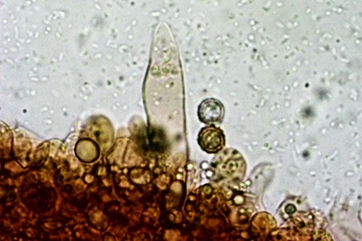 russula-aurea11
