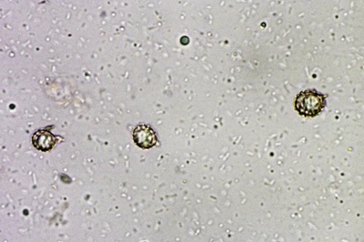 russula-aurea9
