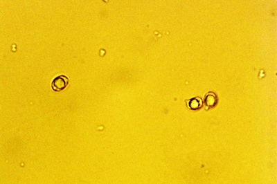 russula-heterophylla6