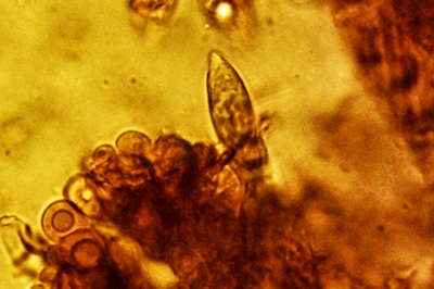 russula-ochroleuca12