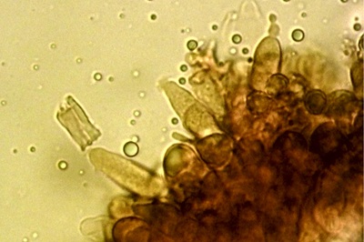 russula-subfoetens11