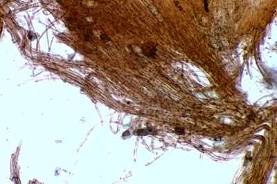 sarcoscypha-coccinea11