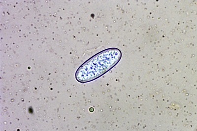 sarcoscypha-coccinea7
