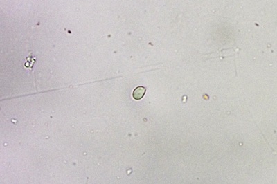 sparassis-brevipes8