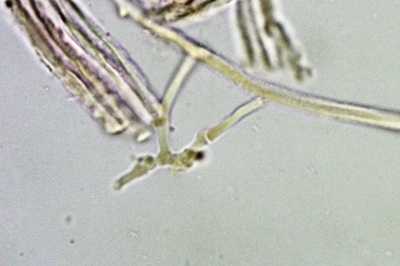 tectella-patellaris12