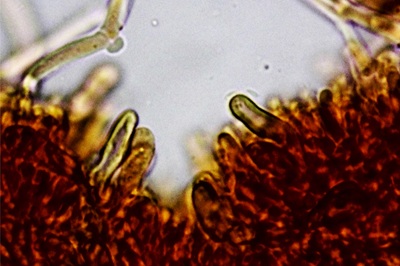 tectella-patellaris9