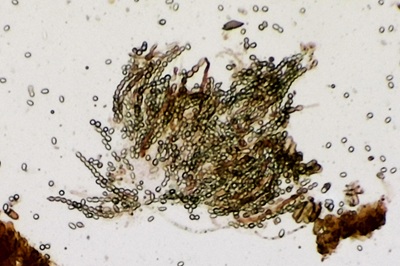 trichoderma-pulvinatum11