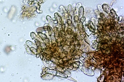 trichoderma-pulvinatum12