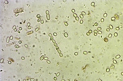 trichoderma-pulvinatum8