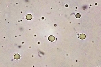 tricholoma-colossus4