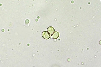 tricholoma-pardinum10