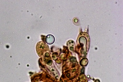 tricholoma-sciodes11