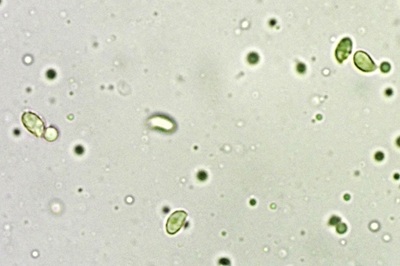 tricholoma-squarrulosum12
