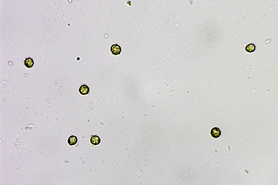 tulostoma-brumale10