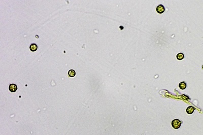 tulostoma-brumale11