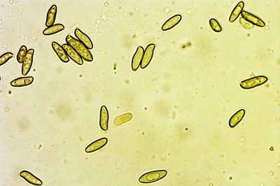 xerocomellus-cisalpinus5