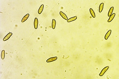 xerocomellus-cisalpinus6